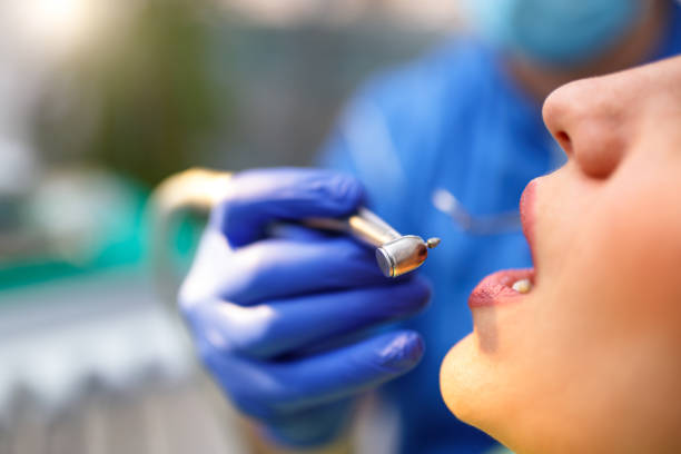Dental Bonding in Enid, OK